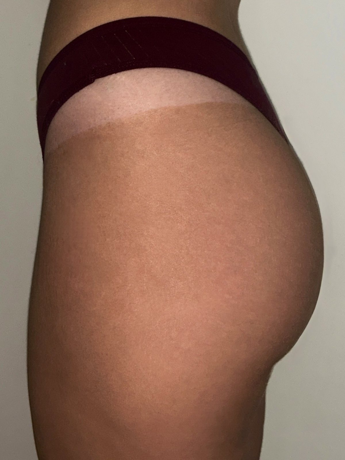 Spray tan colour against an untanned tan line, showing the depth of the result